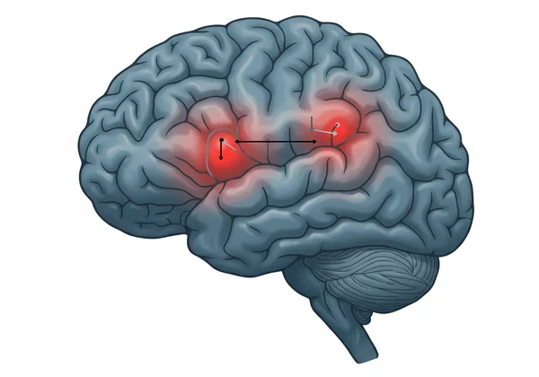 Brain scan highlighting amygdala and prefrontal cortex areas